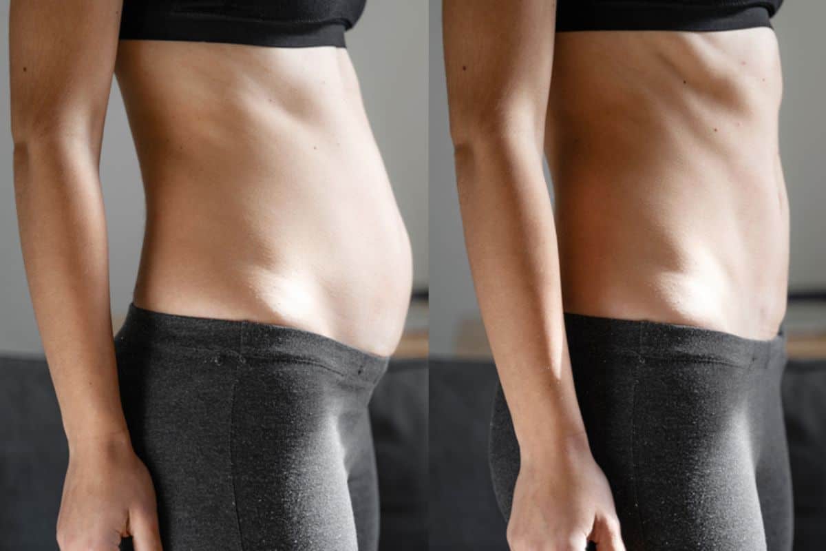 Post-Pregnancy: What Happens to Your Abdominal Muscles After Birth Staffordshire
