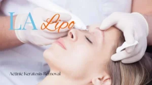 Woman receiving Actinic Keratosis Removal Treatment Staffordshire