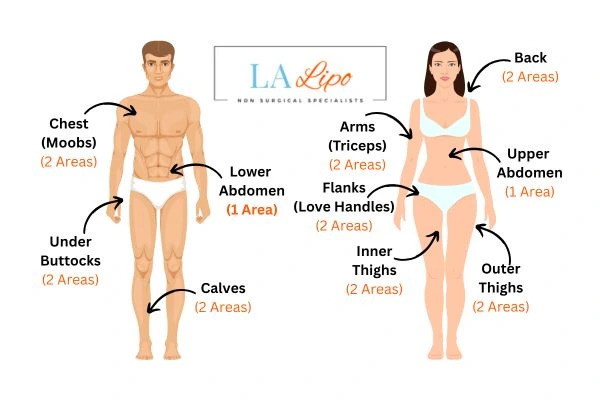 LA LIPO Cryolipolysis Areas Staffordshire