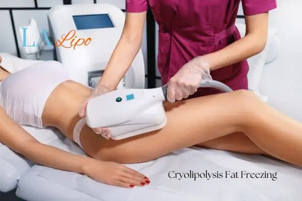Woman receiving coolsculpting Staffordshire treatment on her thighs