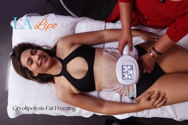 woman getting cryolipolysis Staffordshire