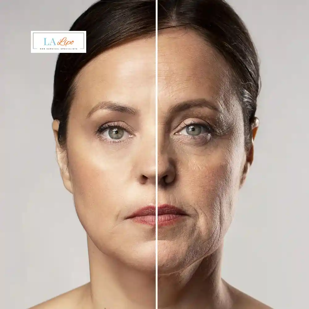 How Can You Tell If Non-Surgical Skin Tightening Is Right for You Staffordshire?
