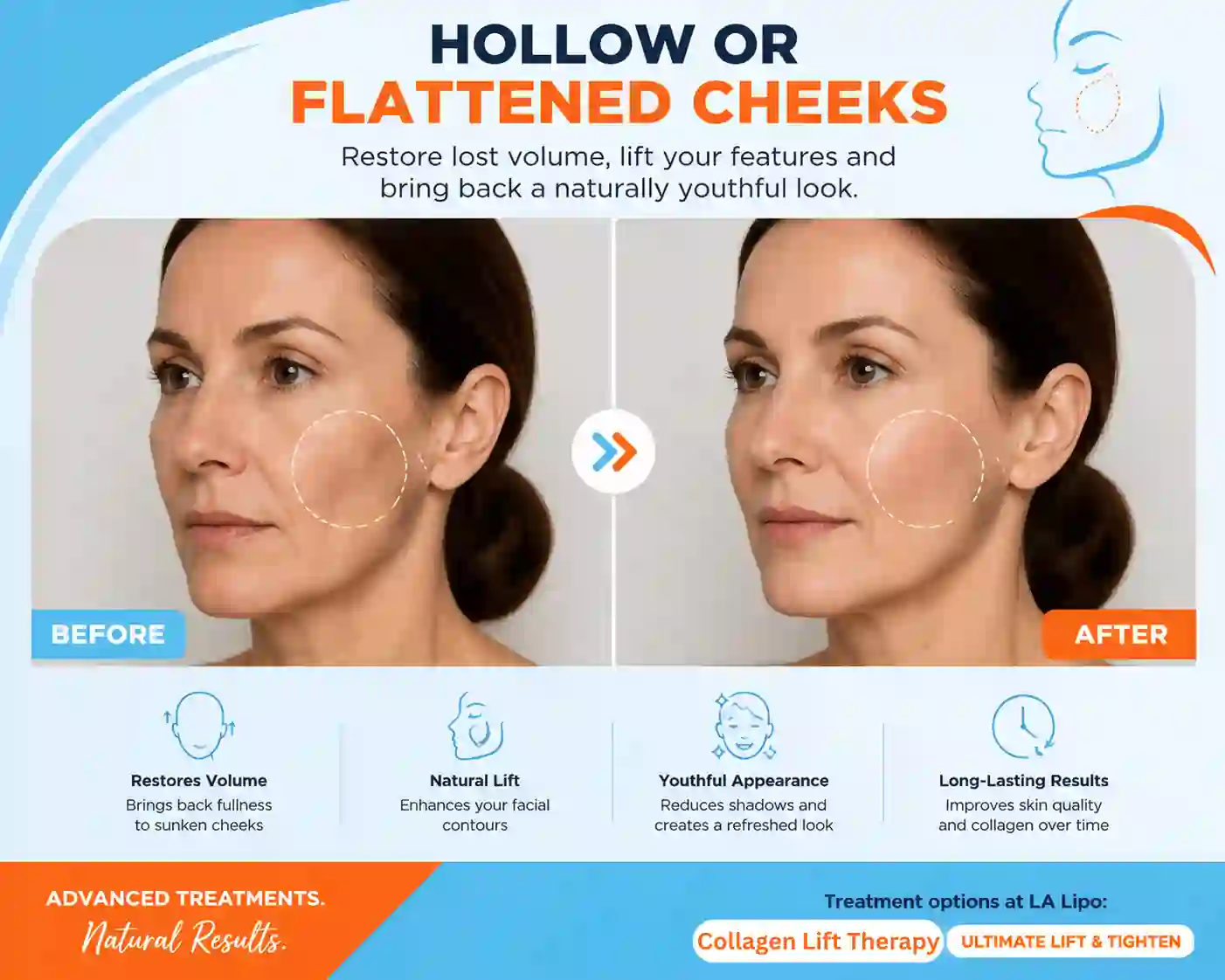 Sign #4: Hollow or Flattened Cheeks Staffordshire