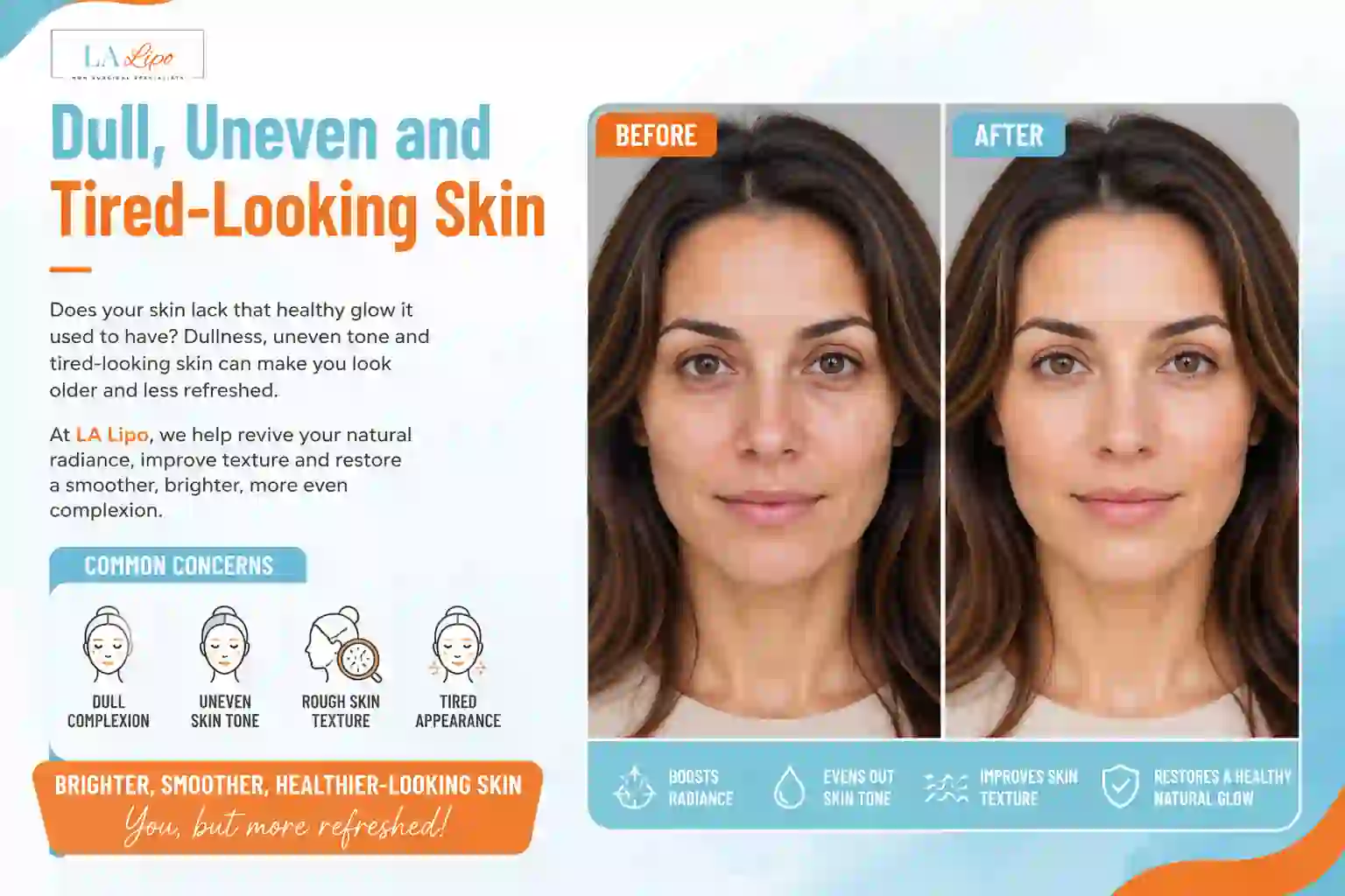Sign #5: Dull, Uneven and Tired-Looking Skin Staffordshire