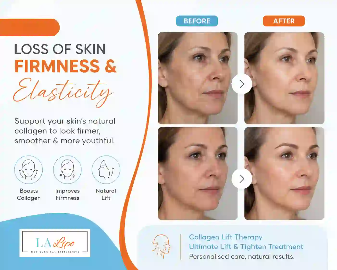 Sign #7: Loss of Skin Firmness and Elasticity Staffordshire