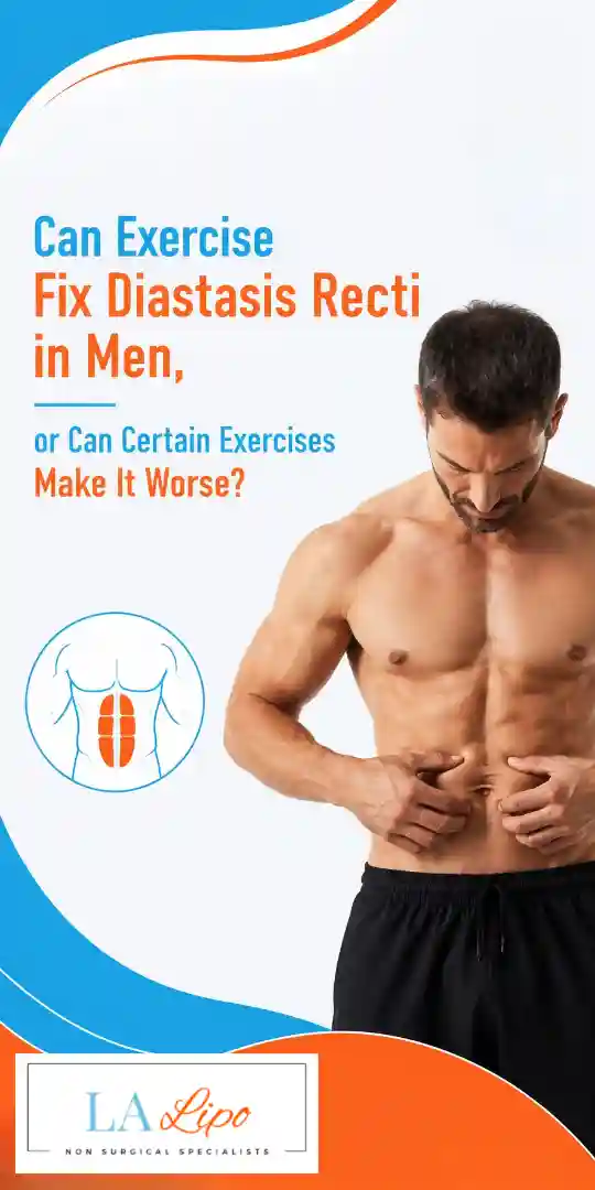 Can Exercise Fix Diastasis Recti in Men, or Can Certain Exercises Make It Worse Staffordshire?